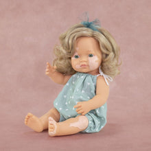 My Friends And Me Baby Doll Girl With Vitiligo 38Cm